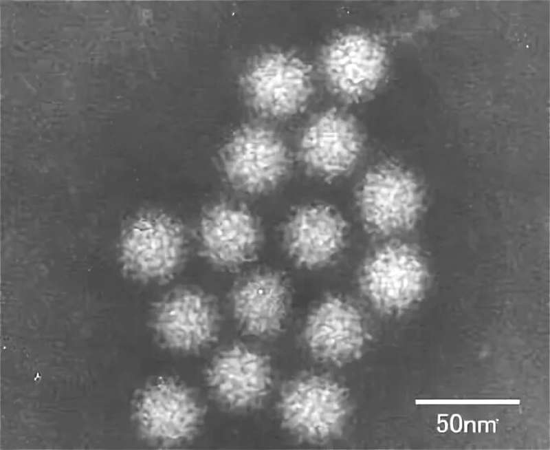 長野の仕出し弁当でノロウイルス食中毒、35人症状。原因は?